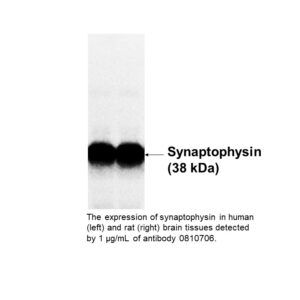 Anti-synaptophysin rabbit polyclonal antibody