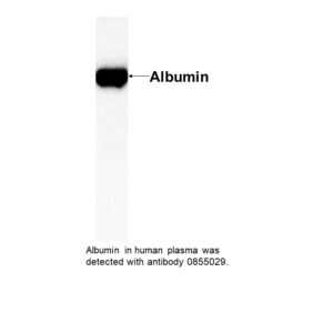IgG Rabbit Anti-Human Albumin