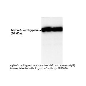IgG Goat Anti-Human Alpha-1-Antitrypsin