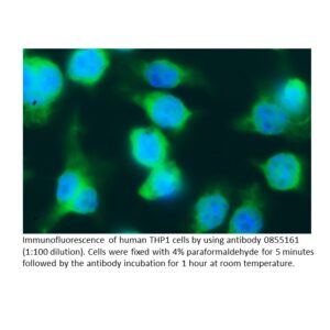 Anti-human lambda Light chain (Free Bence-Jones Protein) goa