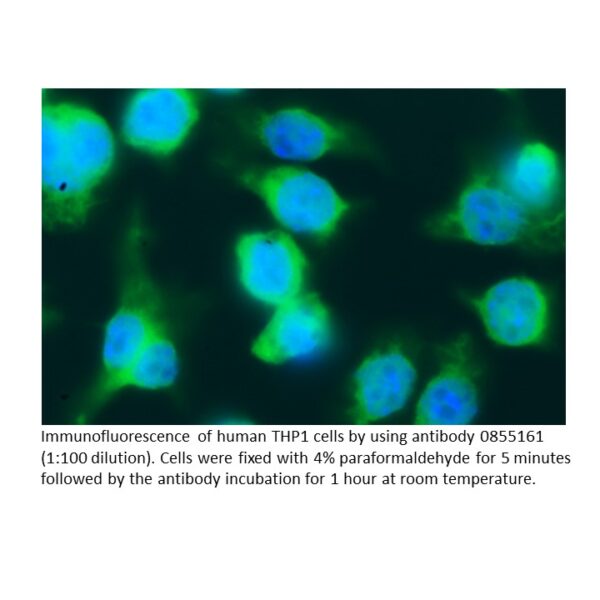 Anti-human lambda Light chain (Free Bence-Jones Protein) goa