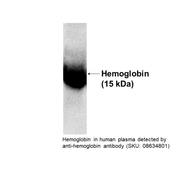 Monoclonal Mouse Anti-Human Hemoglobin