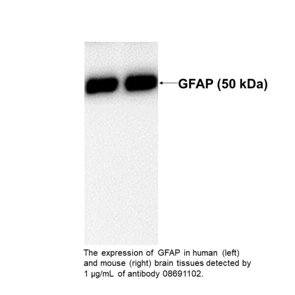 Anti-glial fibrillary acidic protein (GFAP) mouse monoclonal