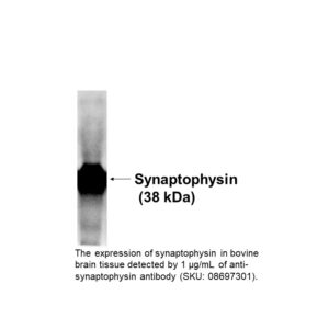 Anti-Synaptophysin IgG1 mouse monoclonal antibody (clone: SY