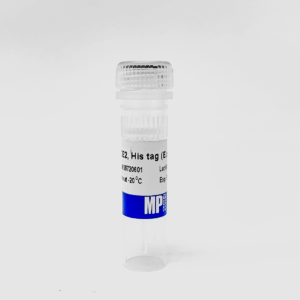 ACE2, His tag (E. coli)