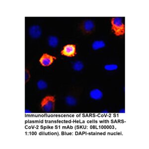 SARS-CoV-2 Spike S1 rabbit Monooclonal Antibody