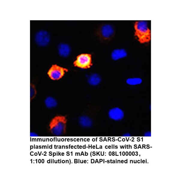 SARS-CoV-2 Spike S1 rabbit Monooclonal Antibody