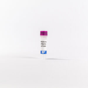 Prostate Specific Antigen