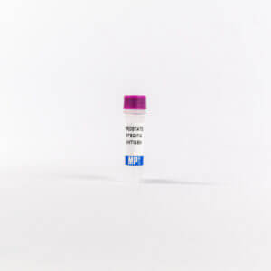 Prostate Specific Antigen