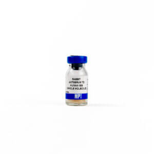 Rabbit Anti-Human IgG (H&L)