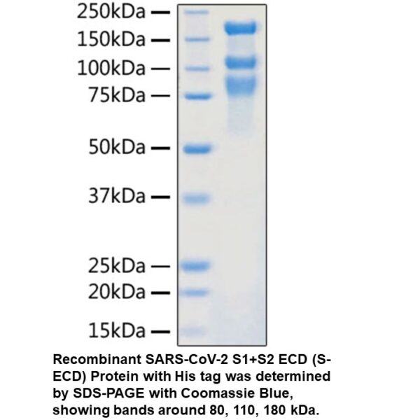 SARS-CoV-2 S1+S2 ECD His tag p re-fusion+post-fusion state