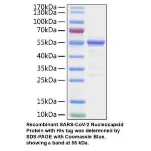 Recombinant SARS-CoV-2 Nucleocapsid Protein (His tag)