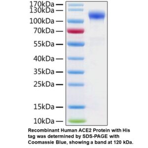 Recombinant Human ACE2 Protein (His tag)