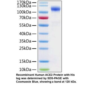 Recombinant Human ACE2 Protein (His tag)