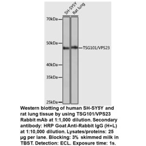 TSG101/VPS23 Rabbit Monoclonal Antibody