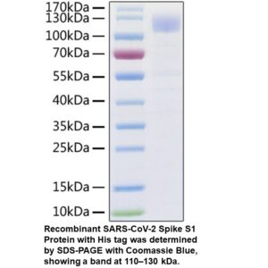 Recombinant SARS-CoV-2 Spike S 1 Protein (His tag)