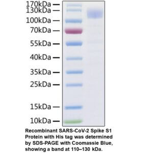 Recombinant SARS-CoV-2 Spike S 1 Protein (His tag)