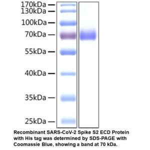 Recombinant SARS-CoV-2 Spike S 2 ECD Protein (His tag)