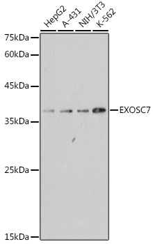 EXOSC7 Rabbit mAb