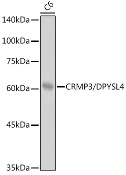 CRMP3/DPYSL4 Rabbit mAb
