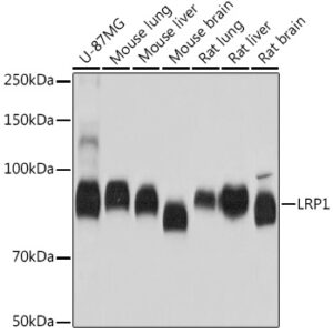 LRP1 Rabbit mAb