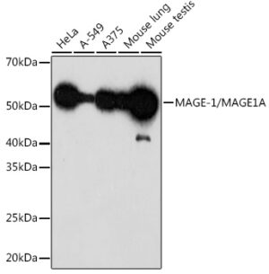 MAGE-1/MAGE1A Rabbit mAb