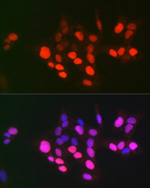 DNA topoisomerase II alpha (TOP2A) Rabbit pAb
