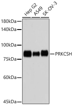 PRKCSH Rabbit mAb