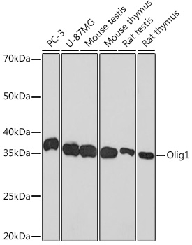 Olig1 Rabbit mAb