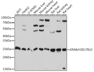 ERAB/HSD17B10 Rabbit mAb