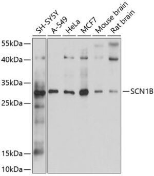 SCN1B Rabbit pAb