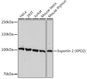 Exportin 2 (XPO2) Rabbit mAb