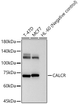 CALCR Rabbit pAb