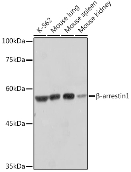 β-arrestin1 Rabbit mAb