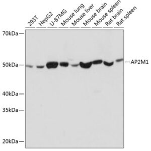 AP2M1 Rabbit mAb