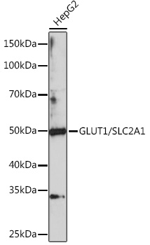 GLUT1/SLC2A1 Rabbit pAb