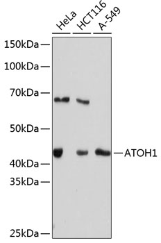 ATOH1 Rabbit mAb