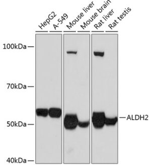 ALDH2 Rabbit mAb