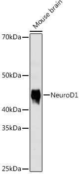 NeuroD1 Rabbit mAb