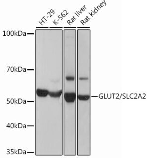 GLUT2/SLC2A2 Rabbit mAb