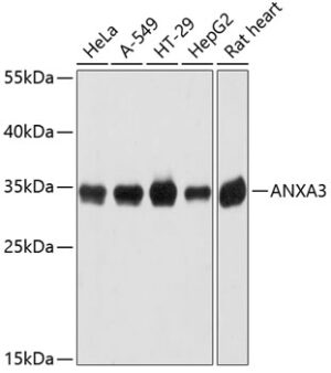 ANXA3 Rabbit pAb