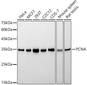 PCNA Rabbit mAb