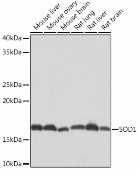 [KD Validated] SOD1 Rabbit mAb