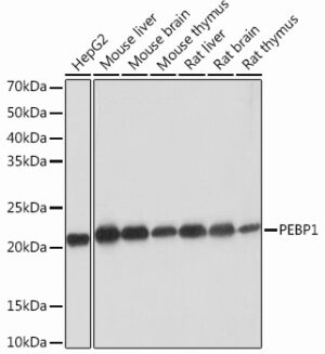PEBP1 Rabbit mAb