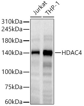 HDAC4 Rabbit mAb