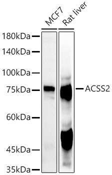 ACSS2 Rabbit pAb
