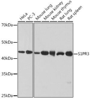 S1PR3 Rabbit mAb