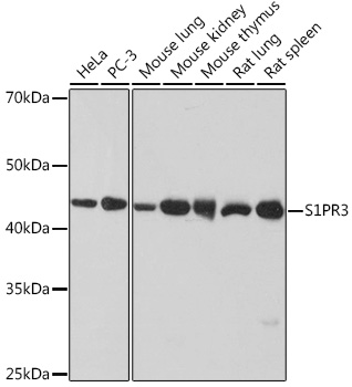 S1PR3 Rabbit mAb