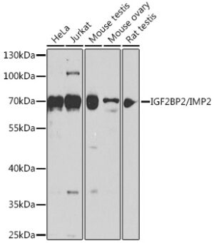 IGF2BP2/IMP2 Rabbit pAb