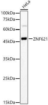 ZNF621 Rabbit pAb